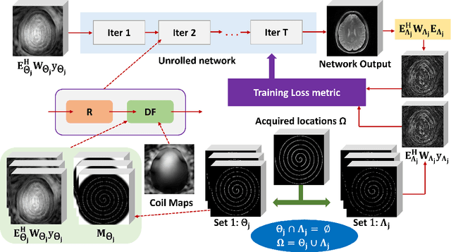 Figure 1 for Non-Cartesian Self-Supervised Physics-Driven Deep Learning Reconstruction for Highly-Accelerated Multi-Echo Spiral fMRI