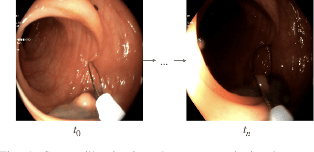 Figure 1 for Multi-Scale Structural-aware Exposure Correction for Endoscopic Imaging