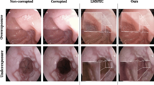 Figure 3 for Multi-Scale Structural-aware Exposure Correction for Endoscopic Imaging