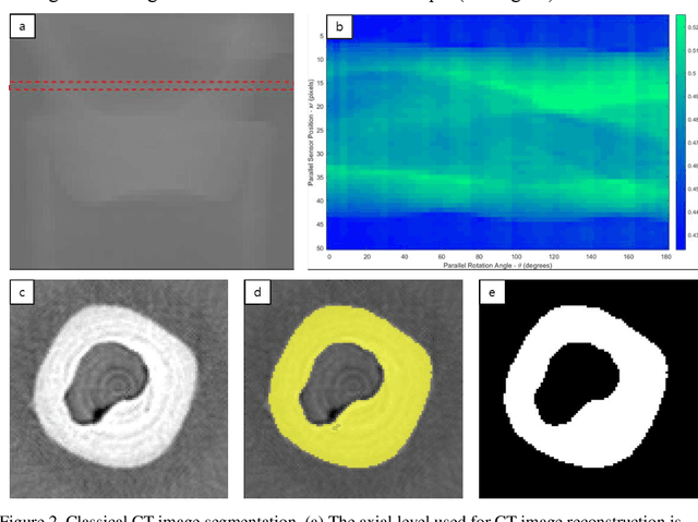 Figure 2 for Quantum optimization algorithms for CT image segmentation from X-ray data
