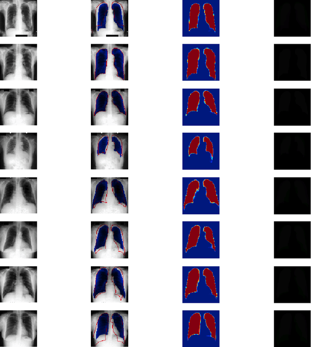 Figure 4 for UNet Based Pipeline for Lung Segmentation from Chest X-Ray Images