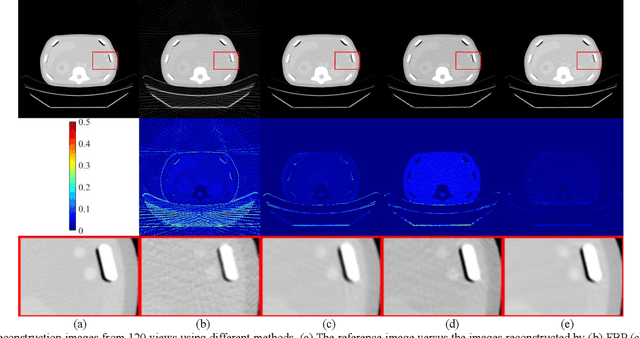 Figure 2 for Generative Modeling in Sinogram Domain for Sparse-view CT Reconstruction