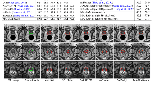 Figure 4 for MA-SAM: Modality-agnostic SAM Adaptation for 3D Medical Image Segmentation