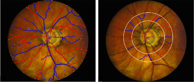 Figure 3 for Fully Automated Artery-Vein ratio and vascular tortuosity measurement in retinal fundus images