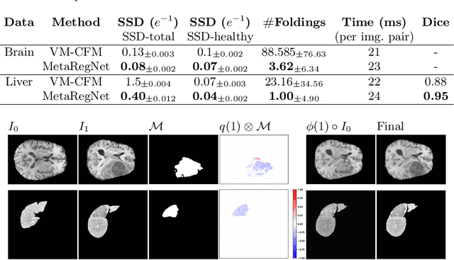 Figure 2 for MetaRegNet: Metamorphic Image Registration Using Flow-Driven Residual Networks