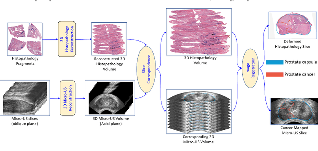 Figure 1 for Image Registration of In Vivo Micro-Ultrasound and Ex Vivo Pseudo-Whole Mount Histopathology Images of the Prostate: A Proof-of-Concept Study