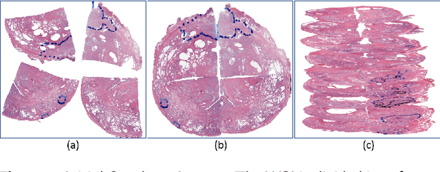 Figure 4 for Image Registration of In Vivo Micro-Ultrasound and Ex Vivo Pseudo-Whole Mount Histopathology Images of the Prostate: A Proof-of-Concept Study