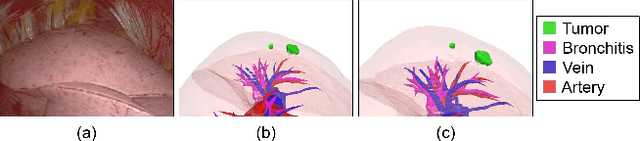 Figure 1 for Shape Reconstruction from Thoracoscopic Images using Self-supervised Virtual Learning