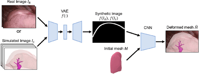 Figure 2 for Shape Reconstruction from Thoracoscopic Images using Self-supervised Virtual Learning