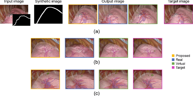Figure 3 for Shape Reconstruction from Thoracoscopic Images using Self-supervised Virtual Learning