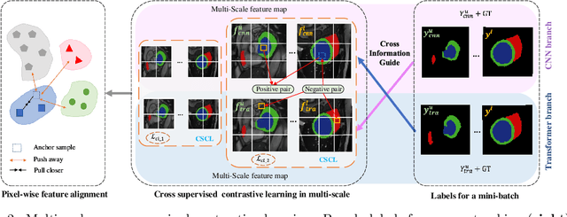 Figure 3 for Multi-Scale Cross Contrastive Learning for Semi-Supervised Medical Image Segmentation