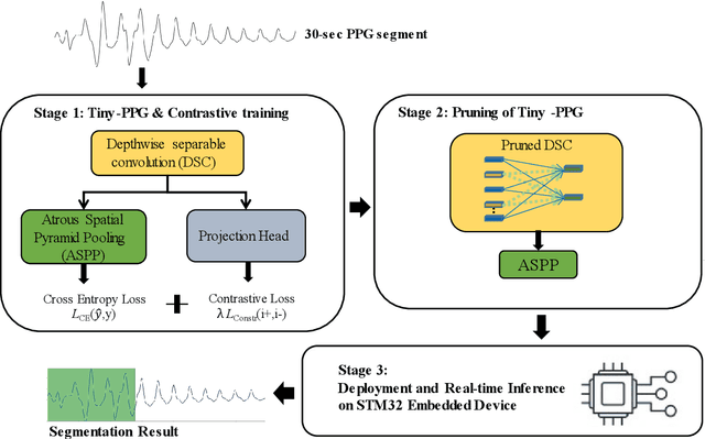 Figure 1 for Tiny-PPG: A Lightweight Deep Neural Network for Real-Time Detection of Motion Artifacts in Photoplethysmogram Signals on Edge Devices