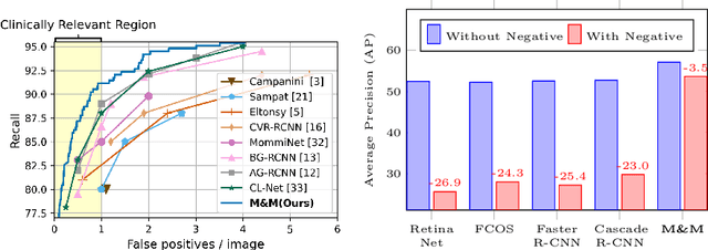 Figure 1 for M&M: Tackling False Positives in Mammography with a Multi-view and Multi-instance Learning Sparse Detector