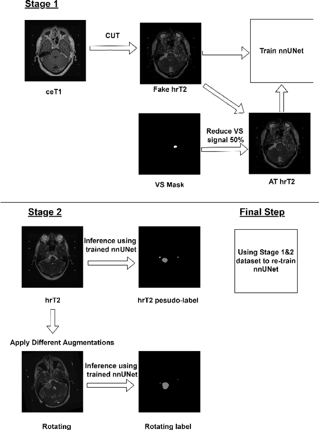 Figure 3 for Weakly Unsupervised Domain Adaptation for Vestibular Schwannoma Segmentation