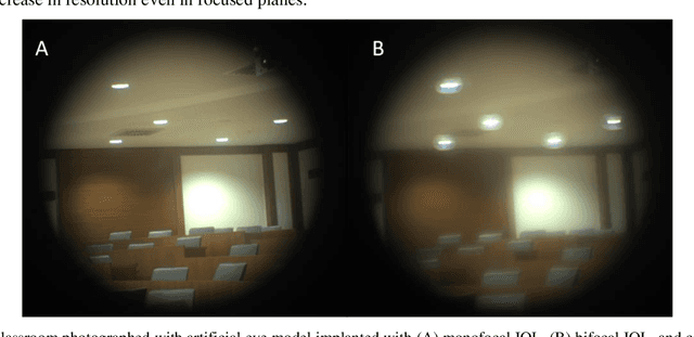 Figure 2 for Artificial Eye Model and Holographic Display Based IOL Simulator