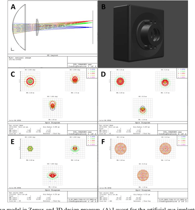Figure 3 for Artificial Eye Model and Holographic Display Based IOL Simulator
