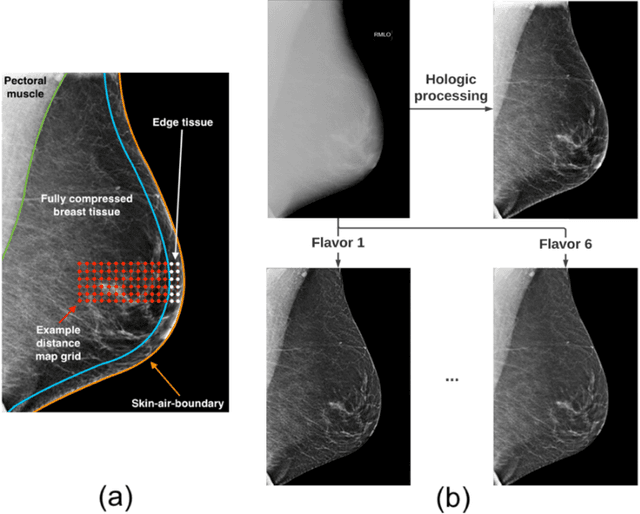 Figure 3 for Robust Cross-vendor Mammographic Texture Models Using Augmentation-based Domain Adaptation for Long-term Breast Cancer Risk