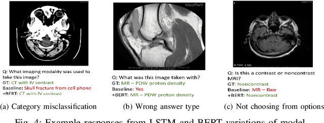 Figure 4 for Visual Question Answering in the Medical Domain