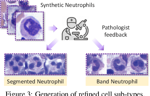 Figure 4 for Aligning Synthetic Medical Images with Clinical Knowledge using Human Feedback