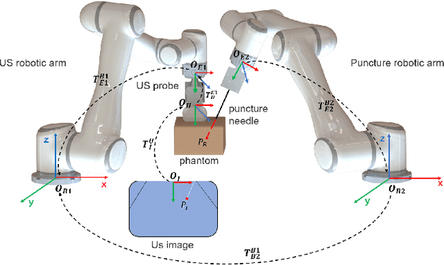 Figure 3 for Fast calibration for ultrasound imaging guidance based on depth camera