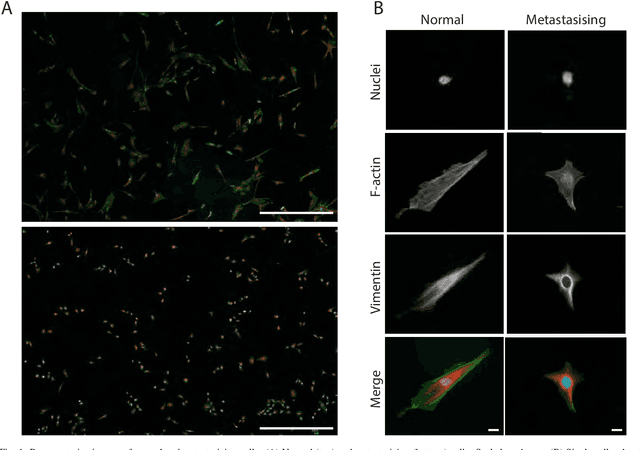 Figure 1 for A novel framework employing deep multi-attention channels network for the autonomous detection of metastasizing cells through fluorescence microscopy