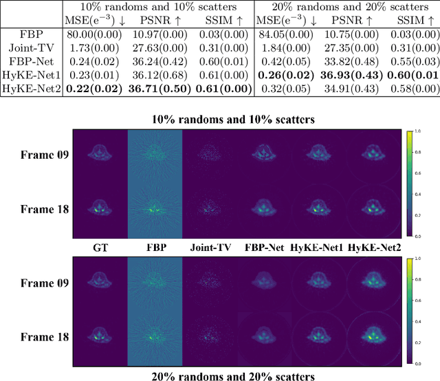 Figure 4 for Hybrid Kinetics Embedding Framework for Dynamic PET Reconstruction