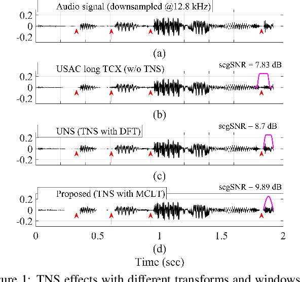 Figure 1 for Hybrid noise shaping for audio coding using perfectly overlapped window