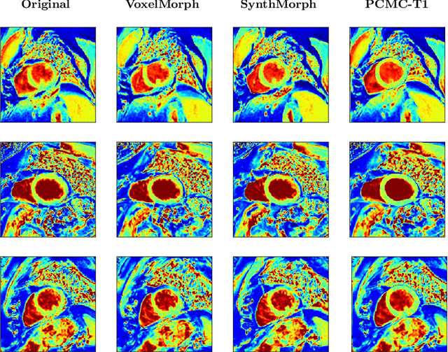 Figure 4 for PCMC-T1: Free-breathing myocardial T1 mapping with Physically-Constrained Motion Correction