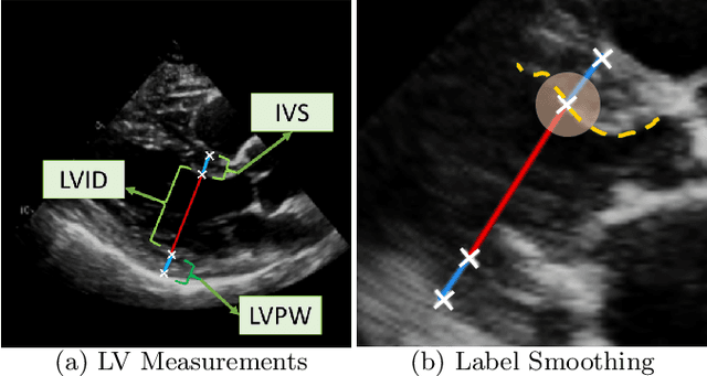 Figure 1 for EchoGLAD: Hierarchical Graph Neural Networks for Left Ventricle Landmark Detection on Echocardiograms
