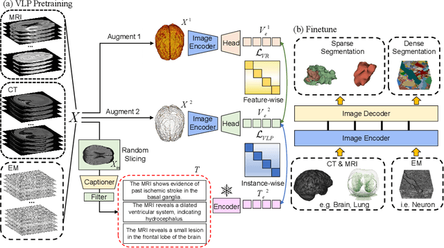 Figure 3 for Generative Text-Guided 3D Vision-Language Pretraining for Unified Medical Image Segmentation
