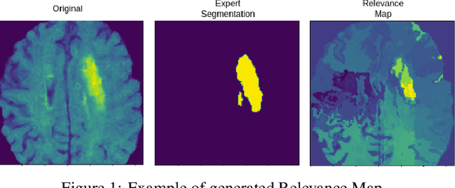 Figure 1 for Optimized Global Perturbation Attacks For Brain Tumour ROI Extraction From Binary Classification Models