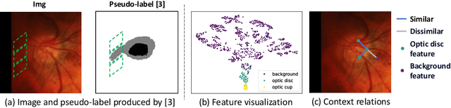 Figure 1 for Context-Aware Pseudo-Label Refinement for Source-Free Domain Adaptive Fundus Image Segmentation
