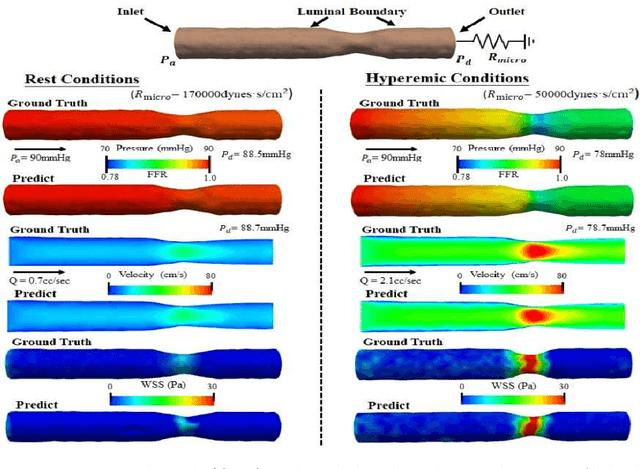 Figure 3 for Voxel2Hemodynamics: An End-to-end Deep Learning Method for Predicting Coronary Artery Hemodynamics