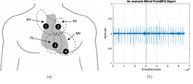 Figure 1 for A Method for Detecting Murmurous Heart Sounds based on Self-similar Properties