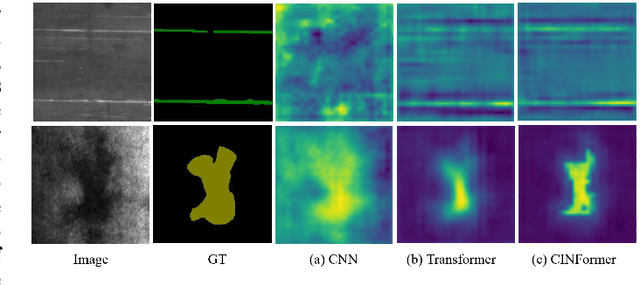 Figure 1 for CINFormer: Transformer network with multi-stage CNN feature injection for surface defect segmentation