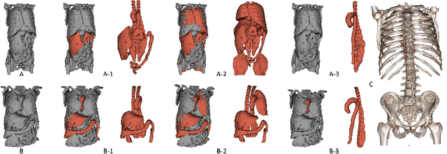 Figure 1 for Anatomy Completor: A Multi-class Completion Framework for 3D Anatomy Reconstruction