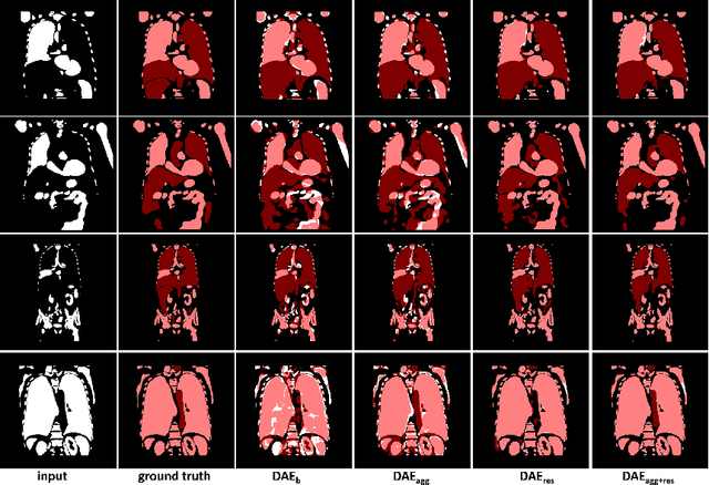 Figure 4 for Anatomy Completor: A Multi-class Completion Framework for 3D Anatomy Reconstruction