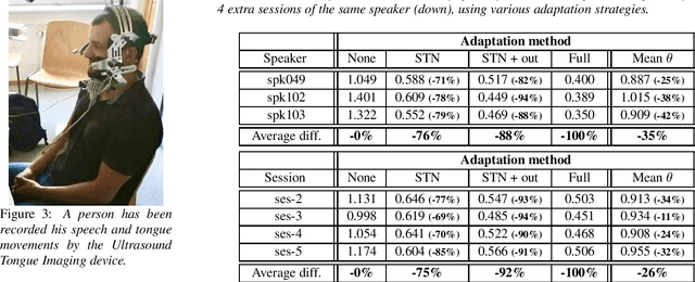 Figure 4 for Adaptation of Tongue Ultrasound-Based Silent Speech Interfaces Using Spatial Transformer Networks