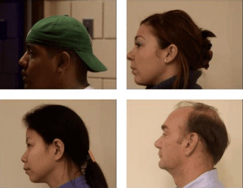 Figure 1 for Evaluating Novel Mask-RCNN Architectures for Ear Mask Segmentation