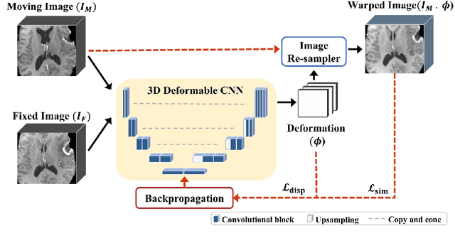 Figure 1 for Self-supervised iRegNet for the Registration of Longitudinal Brain MRI of Diffuse Glioma Patients