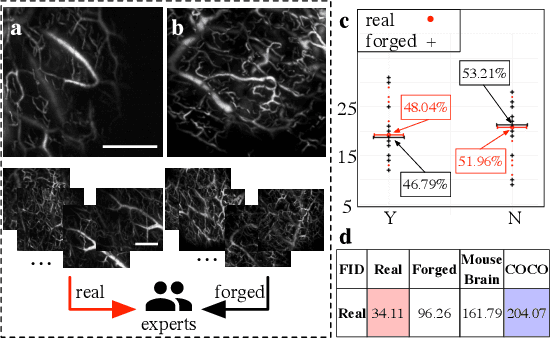 Figure 3 for Self-similarity-based super-resolution of photoacoustic angiography from hand-drawn doodles