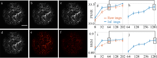 Figure 4 for Self-similarity-based super-resolution of photoacoustic angiography from hand-drawn doodles