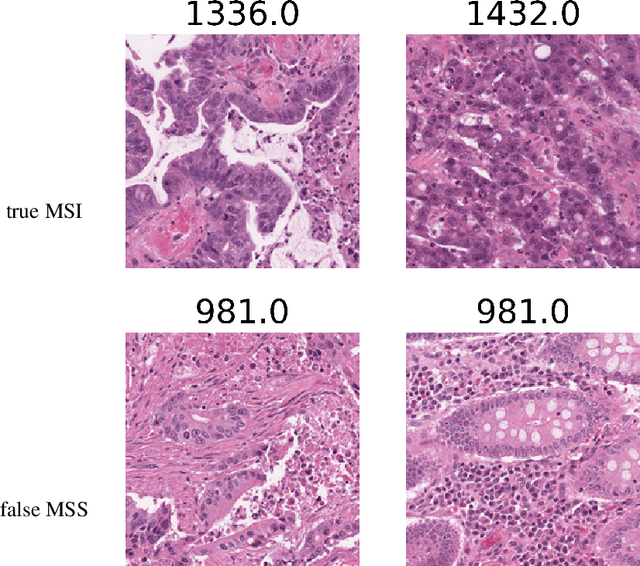 Figure 1 for Biologically-primed deep neural network improves colorectal Cancer Molecular subtypes prediction from H&E stained images