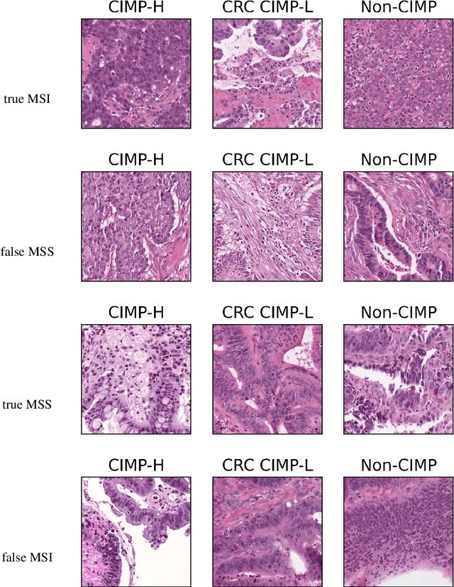 Figure 2 for Biologically-primed deep neural network improves colorectal Cancer Molecular subtypes prediction from H&E stained images