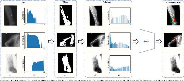 Figure 1 for Detecting Bone Lesions in X-Ray Under Diverse Acquisition Conditions