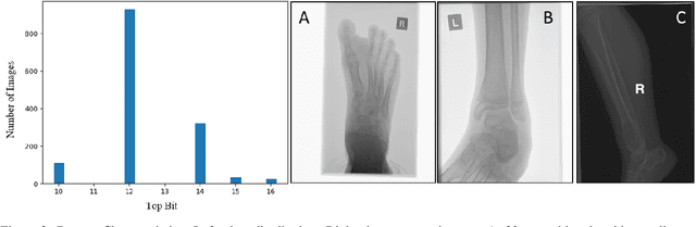 Figure 3 for Detecting Bone Lesions in X-Ray Under Diverse Acquisition Conditions