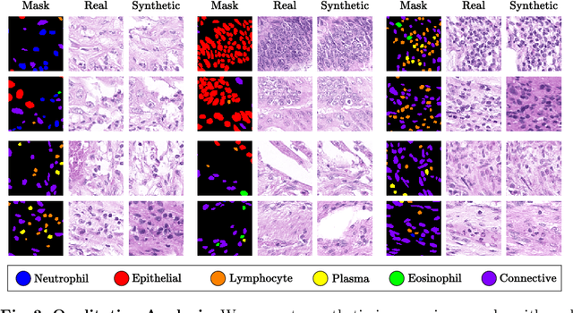 Figure 4 for NASDM: Nuclei-Aware Semantic Histopathology Image Generation Using Diffusion Models