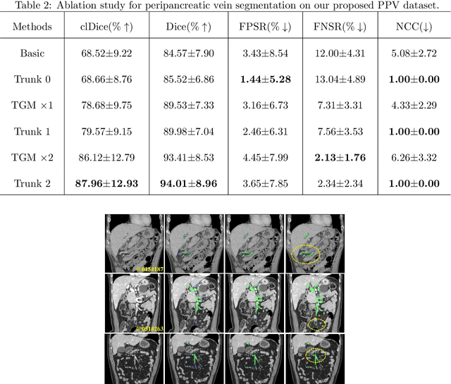 Figure 4 for Automated Peripancreatic Vessel Segmentation and Labeling Based on Iterative Trunk Growth and Weakly Supervised Mechanism