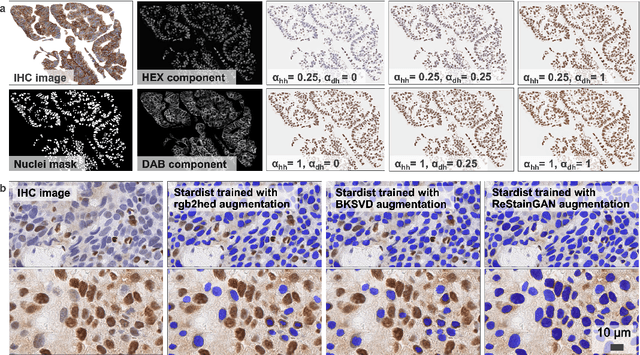 Figure 1 for ReStainGAN: Leveraging IHC to IF Stain Domain Translation for in-silico Data Generation