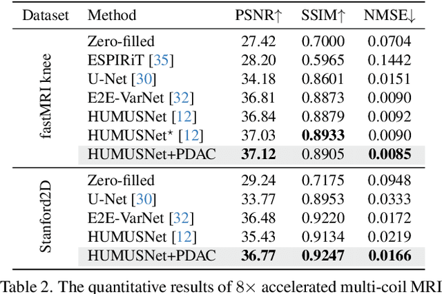 Figure 4 for Progressive Divide-and-Conquer via Subsampling Decomposition for Accelerated MRI